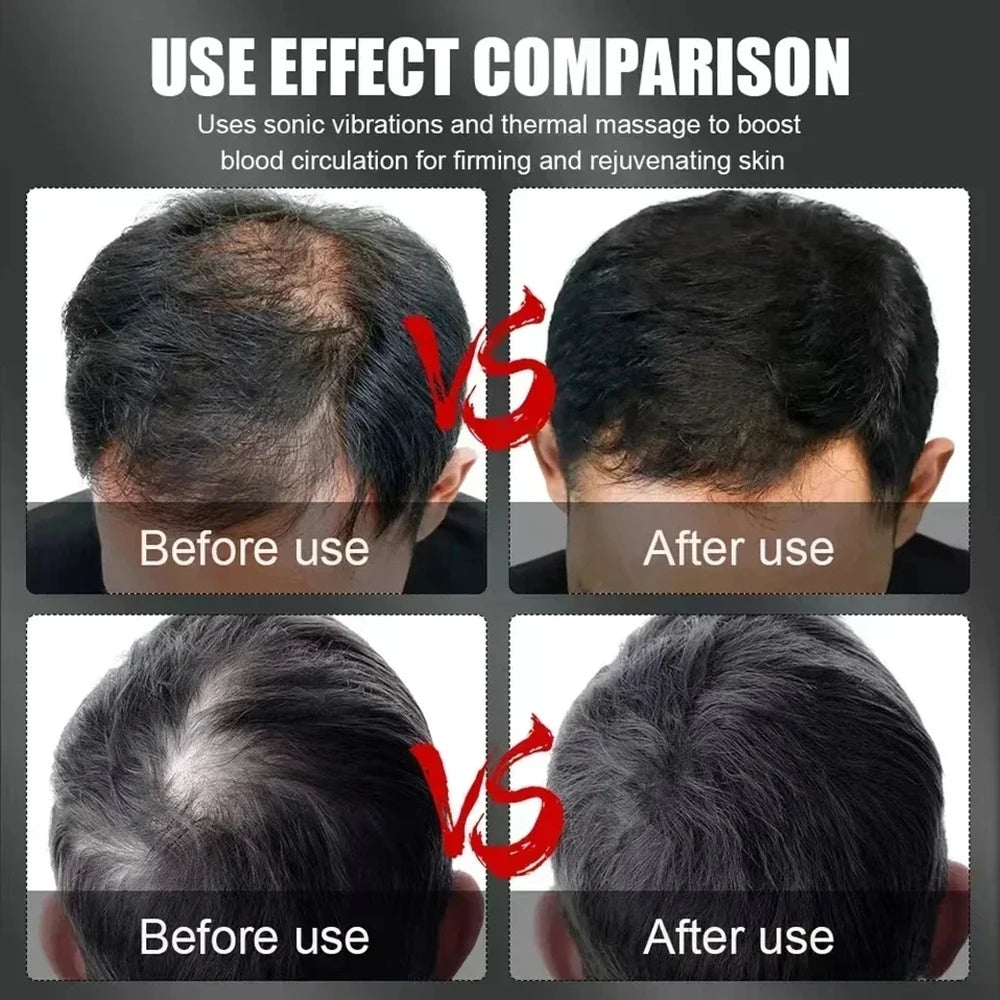 660nm & 850nm Red Light Therapy Hair Growth Cap